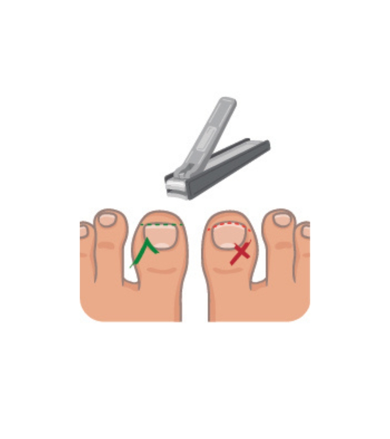 pictogramme : comment se couper les ongles de pieds