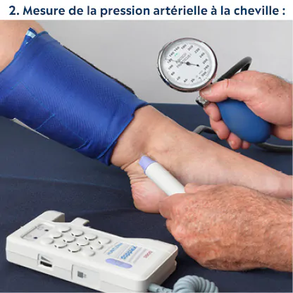 mesure de la pression artérielle à la cheville